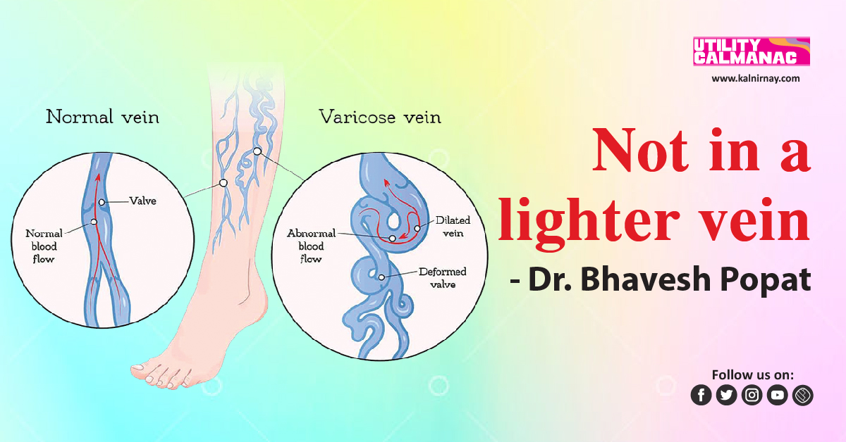 Vein | best treatment for spider veins | varicose doctor | varicose operation | vein stretch in leg | best way to treat varicose veins