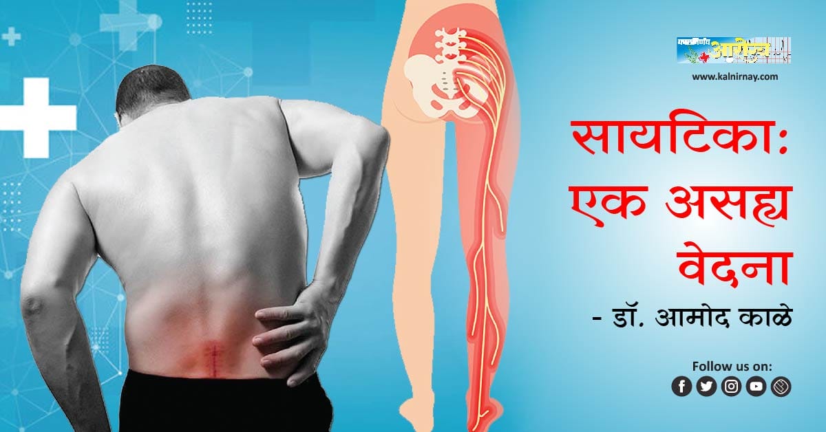 सायटिका | Sciatica | back pain |