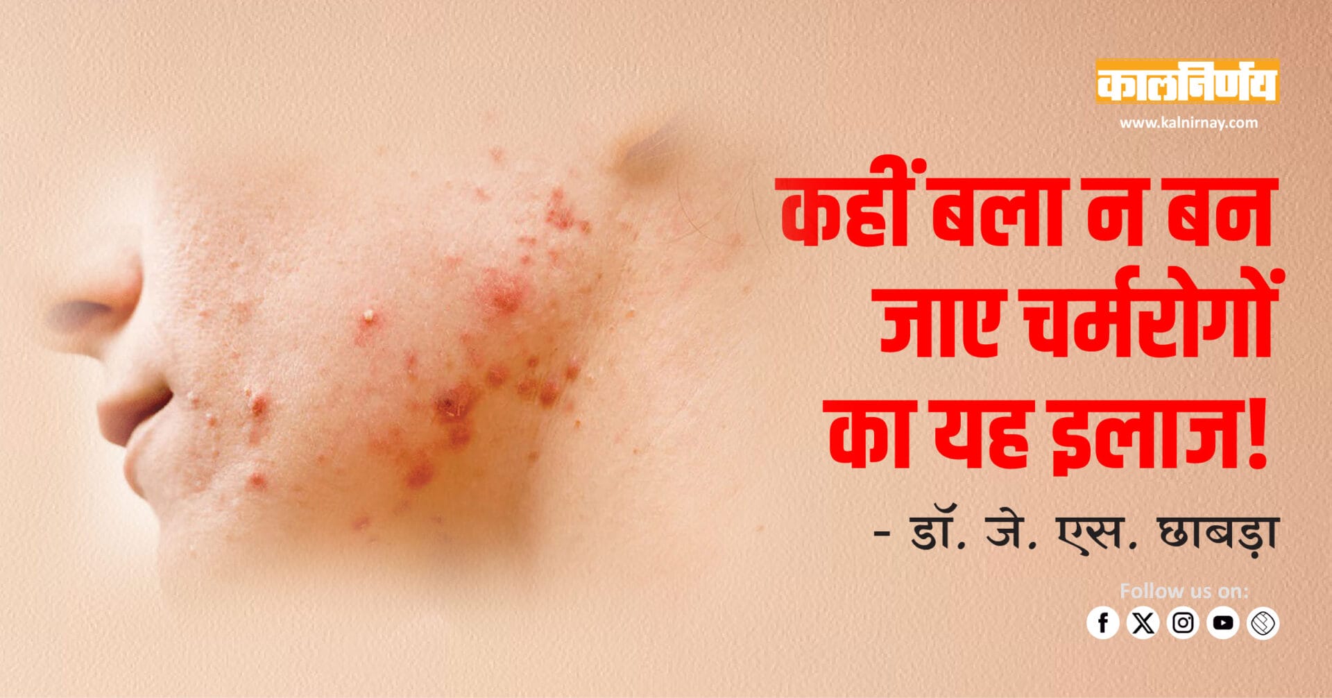 Steroid Creams | Skin Health | Wrong Treatment | Self Medication | Skin Damage | Doctor Advice | Skin Awareness